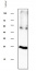 TIP2 | Tonoplast intrinsic protein 2;1, 2;2, 2;3
